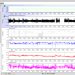 Best Sleep Apnea Analysis Software