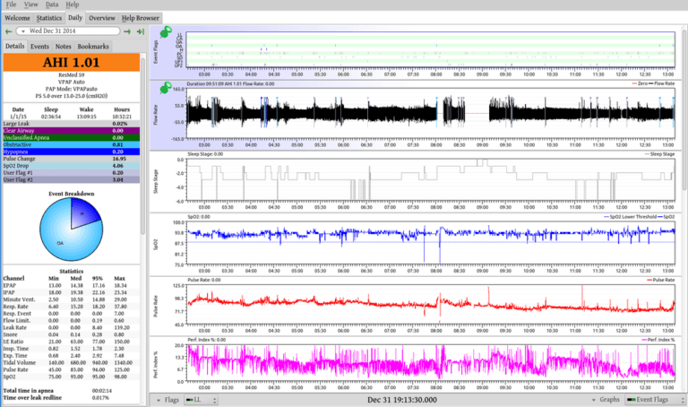 Best Sleep Apnea Analysis Software